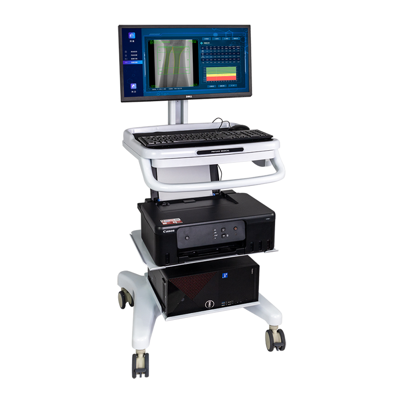 雙能X射線骨密度儀Dexa Pro-I